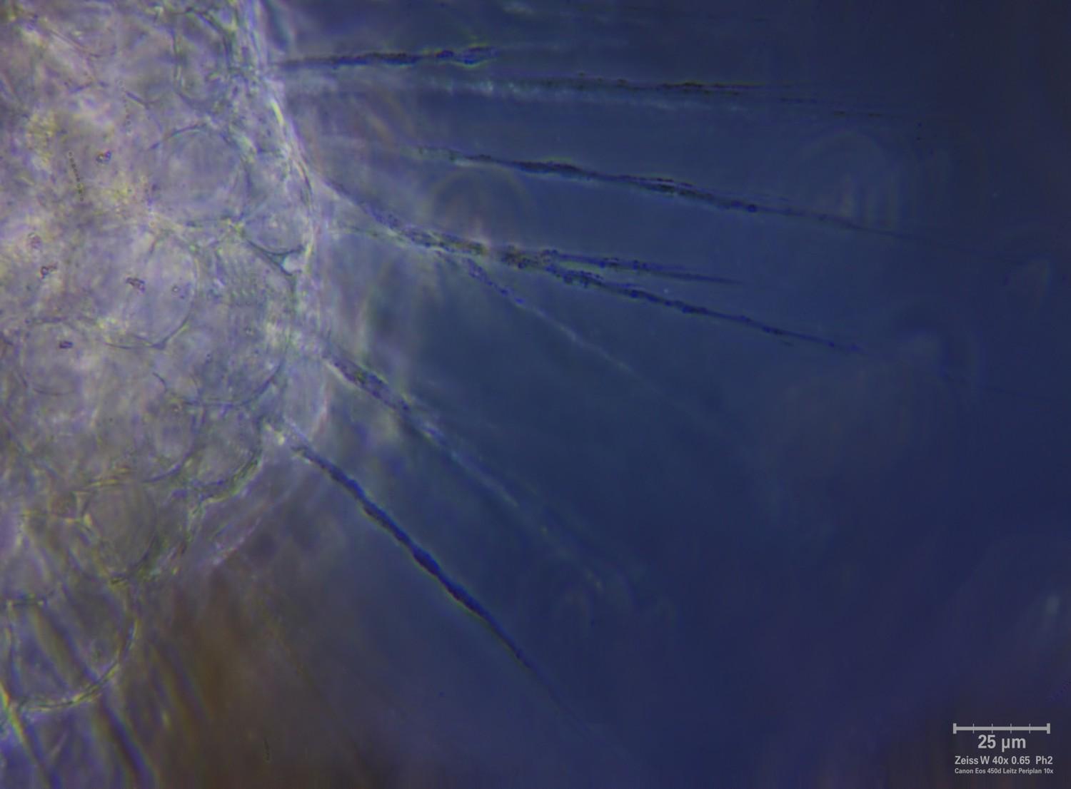 Actinosphaerium eichhorni - CdF